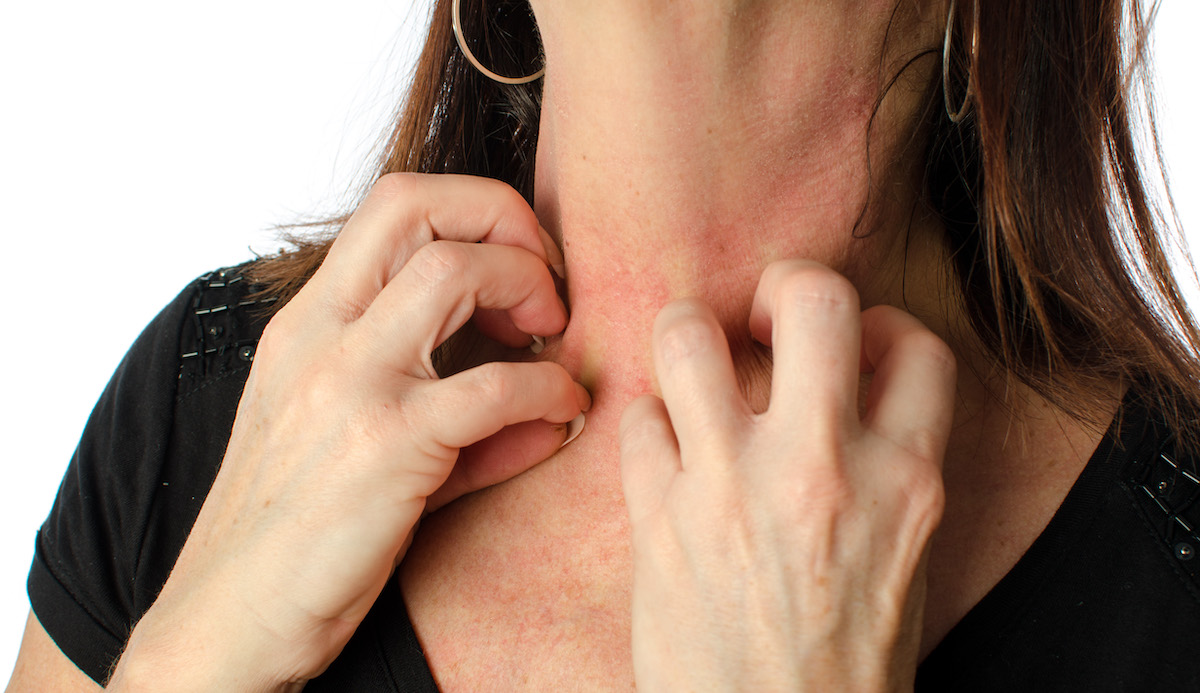 itchy skin